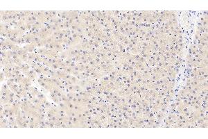 Detection of MMP3 in Human Liver Tissue using Polyclonal Antibody to Matrix Metalloproteinase 3 (MMP3) (MMP3 抗体  (AA 247-370))