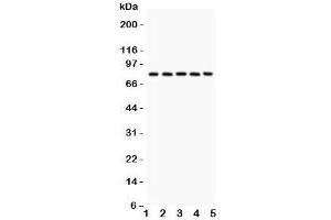 Western blot testing of Calpain antibody and Lane 1:  rat lung;  2: mouse lung;  3: human A549;  4: (h) COLO320;  5: (h) Jurkat. (Calpain antibody  (Catalytic Subunit))
