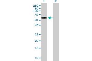 Western Blot analysis of MAP3K7IP1 expression in transfected 293T cell line by MAP3K7IP1 MaxPab polyclonal antibody. (TAB1 antibody  (AA 1-504))