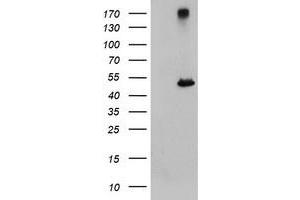 Image no. 1 for anti-Carboxypeptidase A1 (Pancreatic) (CPA1) antibody (ABIN1497593) (CPA1 antibody)