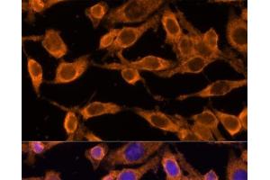 Immunofluorescence analysis of HeLa cells using USP36 Polyclonal Antibody at dilution of 1:100 (40x lens). (USP36 antibody)