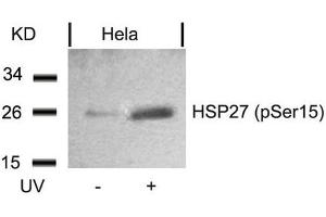 Western blot analysis of extracts from Hela cells untreated or treated with UV using HSP27(Phospho-Ser15) Antibody. (HSP27 antibody  (pSer15))