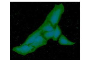 ICC/IF analysis of PGM1 in HeLa cells line, stained with DAPI (Blue) for nucleus staining and monoclonal anti-human PGM1 antibody (1:100) with goat anti-mouse IgG-Alexa fluor 488 conjugate (Green). (Phosphoglucomutase 1 antibody)