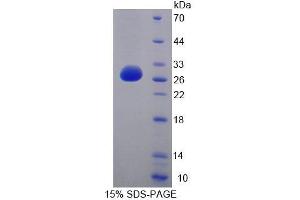 SDS-PAGE analysis of Human LYPLA1 Protein. (LYPLA1 Protein)