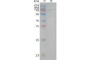 CNR1 Protein