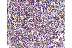 Immunohistochemistry (IHC) image for anti-Apoptosis, Caspase Activation Inhibitor (AVEN) (N-Term) antibody (ABIN1031252) (AVEN antibody  (N-Term))