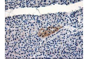 Immunohistochemical staining of paraffin-embedded Human pancreas tissue using anti-TBC1D21 mouse monoclonal antibody. (TBC1D21 antibody)