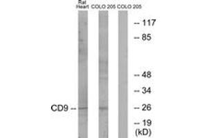 Western Blotting (WB) image for anti-CD9 (CD9) (AA 101-150) antibody (ABIN2889898) (CD9 antibody  (AA 101-150))