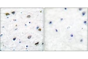 Immunohistochemistry analysis of paraffin-embedded human brain tissue, using GABA-RB (Ab-434) Antibody. (GABA-RB (AA 401-450) antibody)