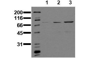 Western Blotting (WB) image for anti-Signal Transducer and Activator of Transcription 1, 91kDa (STAT1) (phosphorylated) antibody (ABIN126895) (STAT1 antibody  (phosphorylated))