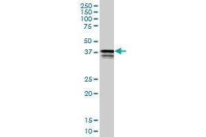 PCBP2 monoclonal antibody (M02), clone 1B6. (PCBP2 antibody  (AA 1-362))