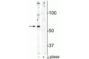Western blot of mouse hippocampal lysate showing specific immunolabeling of the ~65 kDa Munc18-1 protein phosphorylated at Ser241 in the first lane (-). (STXBP1 antibody  (pSer241))