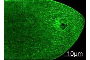 Immunofluorescence Staining of nematode tissue with MYH Mouse mAb (11C2) diluted at 1:100 (Provide by Tsinghua University) . (Myosin Heavy Chain antibody)