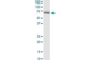 HSPA1A polyclonal antibody (A01), Lot # 070831JCSe. (HSP70 1A antibody  (AA 1-641))