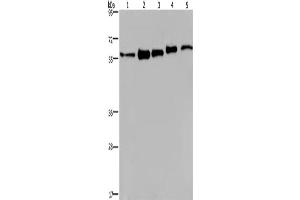 Western Blotting (WB) image for anti-Heterogeneous Nuclear Ribonucleoprotein L (HNRNPL) antibody (ABIN2433135) (HNRNPL antibody)