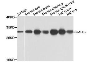 Western blot analysis of extracts of various cells, using CALB2 antibody. (Calretinin antibody)