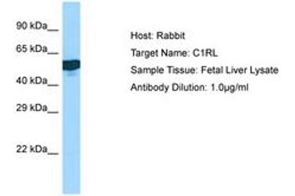 C1RL antibody  (AA 190-239)