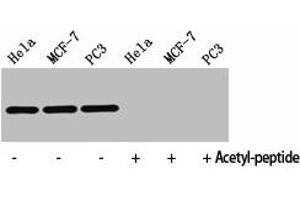 Western Blot analysis of HELA MCF7 PC3 cells using Acetyl-Histone H4 (K8) Polyclonal Antibody (HIST1H4A antibody  (acLys8))