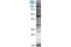 Western Blotting (WB) image for TSG101 293T Cell Transient Overexpression Lysate(Denatured) (ABIN1333798)