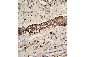 Formalin-fixed and paraffin-embedded human normal lung with TYRO10 Antibody, which was peroxidase-conjugated to the secondary antibody, followed by DAB staining. (DDR2 antibody)