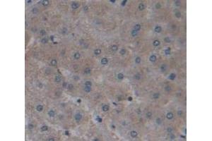 IHC-P analysis of Human Tissue, with DAB staining. (EPHA1 antibody  (AA 599-842))