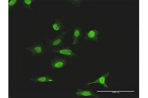 Immunofluorescence of purified MaxPab antibody to SUMO2 on HeLa cell. (SUMO2 antibody  (AA 1-95))