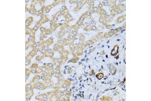 Immunohistochemistry of paraffin-embedded human liver using CSH1 antibody. (CSH1 antibody)