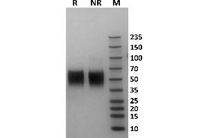 Human Fc gamma RIIIb / CD16b (NA2) protein on Coomassie Blue stained SDS-PAGE under non-reducing (NR) and reducing (R) conditions. (FCGR3B Protein (AA 17-200) (His-Avi Tag))