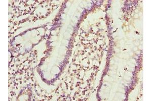 Immunohistochemistry of paraffin-embedded human small intestine tissue using ABIN7164405 at dilution of 1:100 (CIAO1 antibody  (AA 1-339))