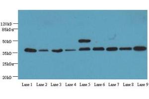 Western Blotting (WB) image for anti-Glyceraldehyde-3-Phosphate Dehydrogenase (GAPDH) (AA 3-105) antibody (ABIN4219318) (GAPDH antibody  (AA 3-105))