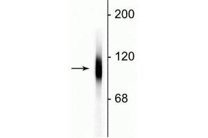 Western blot of HeLa cell lysate showing specific immunolabeling of the ~100 kDa LAMP1 protein. (LAMP1 antibody)