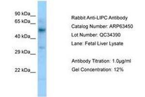 Image no. 1 for anti-Lipase, Hepatic (LIPC) (C-Term) antibody (ABIN6749983) (LIPC antibody  (C-Term))