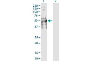 Western Blot analysis of DDC expression in transfected 293T cell line by DDC monoclonal antibody (M18), clone 8E8. (DDC antibody  (AA 1-480))