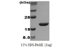 Figure annotation denotes ug of protein loaded and % gel used. (IL1RN Protein)