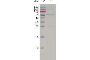 TIMP4 Protein (AA 30-224) (Fc Tag)