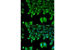 Immunofluorescence analysis of A549 cells using IL17F antibody (ABIN5973881). (IL17F antibody)