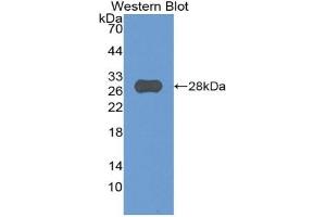 Detection of Recombinant SIGLEC3, Mouse using Polyclonal Antibody to Cluster Of Differentiation 33 (CD33) (CD33 antibody  (AA 18-240))