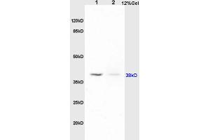 SDS-PAGE (SDS) image for anti-Platelet-Activating Factor Receptor (PTAFR) (AA 231-342) antibody (ABIN687127)