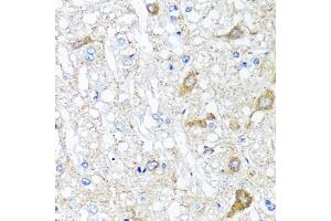 Immunohistochemistry of paraffin-embedded rat brain using SERPINA7 antibody. (SERPINA7 antibody)