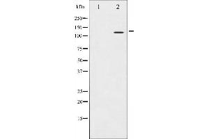Western blot analysis of Integrin beta3 expression in NIH-3T3 whole cell lysates,The lane on the left is treated with the antigen-specific peptide. (Integrin beta 3 antibody  (C-Term))