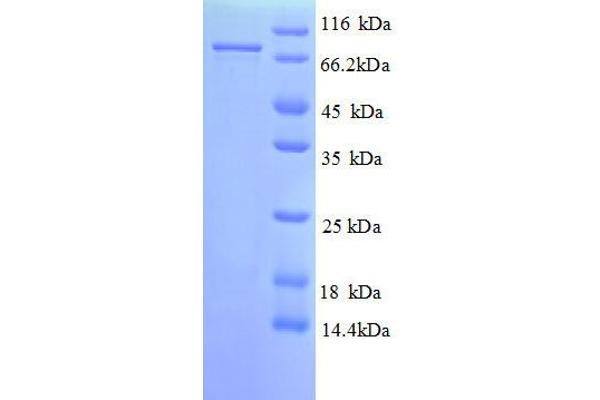 PSMD11 Protein (AA 2-422, full length) (GST tag)