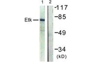 Western Blotting (WB) image for anti-BMX Non-Receptor Tyrosine Kinase (BMX) (AA 6-55) antibody (ABIN2888731) (BMX antibody  (AA 6-55))