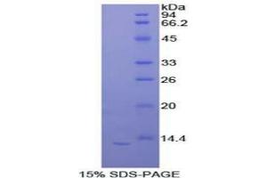 SDS-PAGE (SDS) image for Interleukin 33 (IL33) ELISA Kit (ABIN6720510)