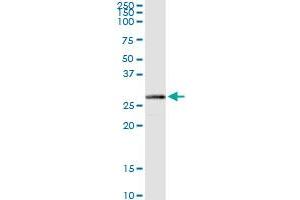 HIBADH MaxPab rabbit polyclonal antibody. (HIBADH antibody  (AA 1-336))