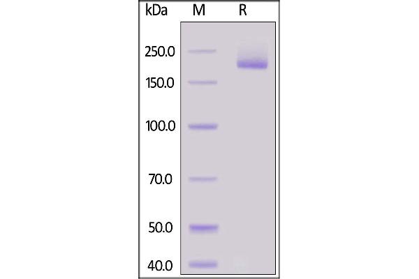 Sialoadhesin/CD169 Protein (AA 20-1641) (His tag)