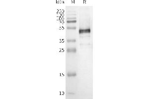 Western Blotting (WB) image for Olfactory Receptor 1E5 (OR1E1) protein (ABIN7538414)