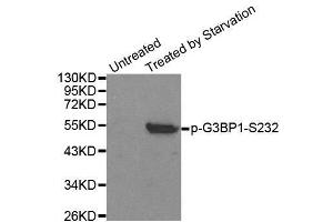 Western blot analysis of extracts from 293 cells, using Phospho-G3BP1-S232 antibody. (G3BP1 antibody  (pSer232))