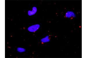 Proximity Ligation Analysis of protein-protein interactions between BIRC2 and CASP9. (BIRC2 antibody  (AA 1-618))