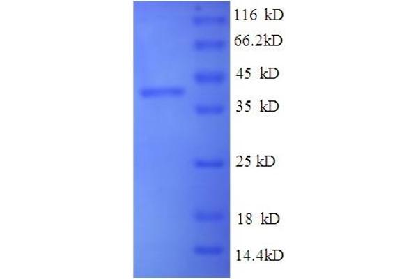 WNT2 Protein (AA 26-360) (His tag)