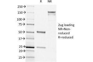 SDS-PAGE Analysis of Purified, BSA-Free CD44v6 Antibody (clone CD44v6/1246). (CD44v6 antibody)